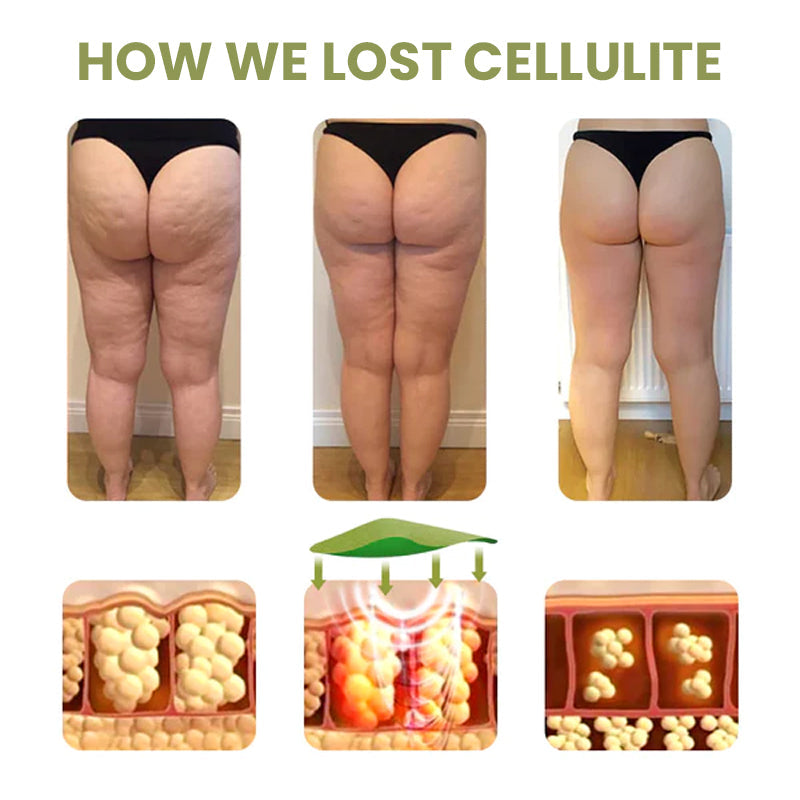 Dr. Slim™ Cellulite Reduction Patches