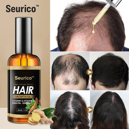 Seurico™ Rapid Hair Growth Serum - Rejuvenate your hair with our proven product!